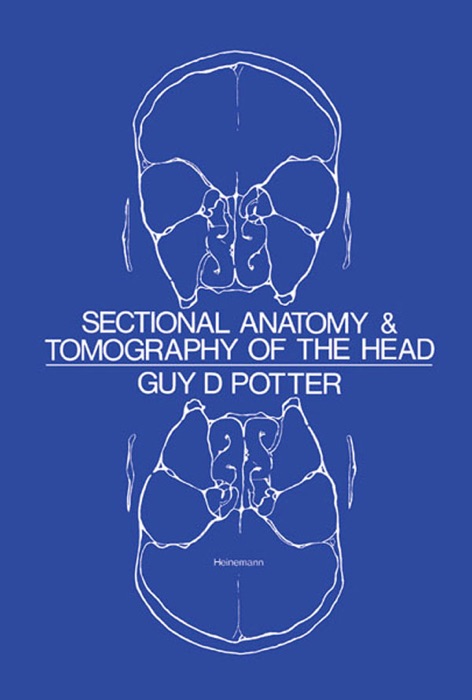 Sectional Anatomy and Tomography of the Head