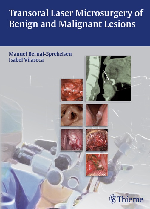 Transoral Laser Microsurgery of Benign and Malignant Lesions