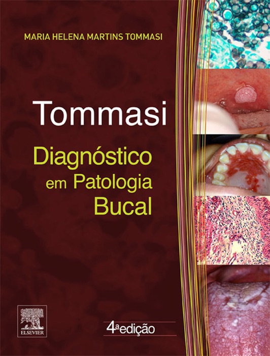 Tommasi diagnóstico em patologia bucal: 4ª edição