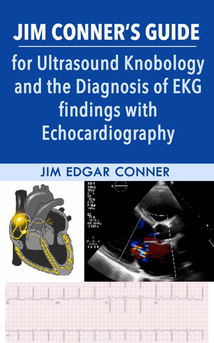 Jim Conner's Guide for Ultrasound Knobology and the Diagnosis of EKG Findings with Echocardiography