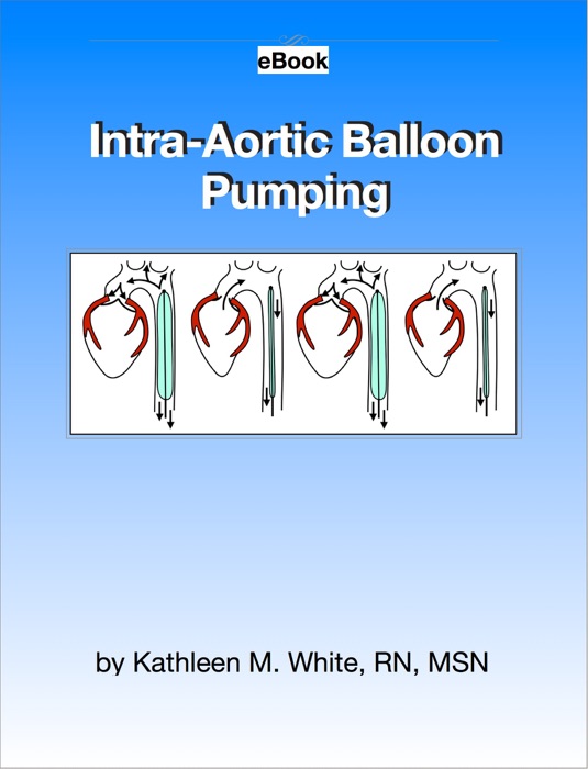 Intra-Aortic Balloon Pumping