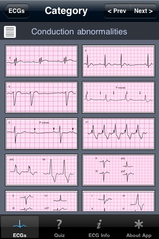 ECG Pocket Reference Free