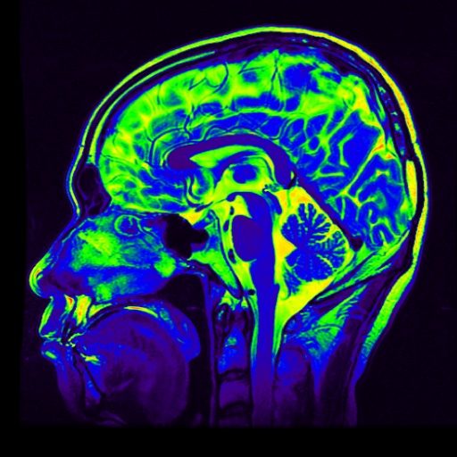 Brain MRI Atlas HD