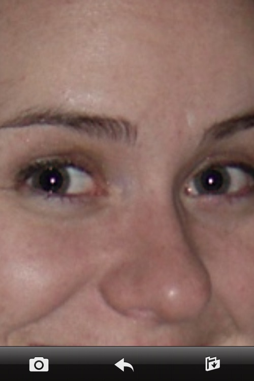 Red Eye Remover HD
