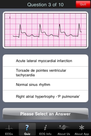 ECG Pocket Reference