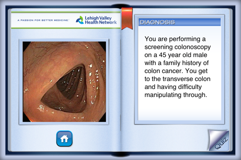 Lower Endoscopy screenshot 3