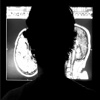 Brain MRI Atlas