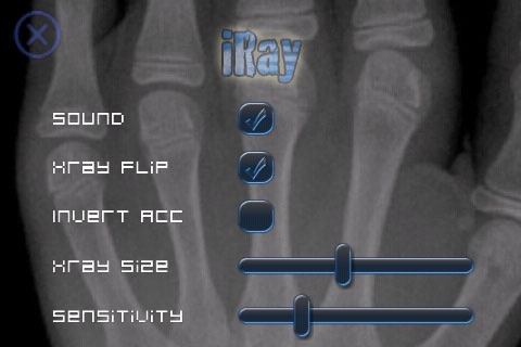 iRay Mobile X-Ray