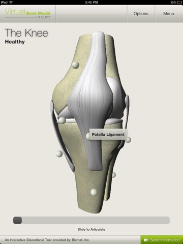 Biomet Virtual Bone Model screenshot 2