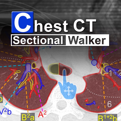 Chest CT Sectional Walker