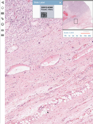 Aperio ePathViewer for iPadのおすすめ画像1
