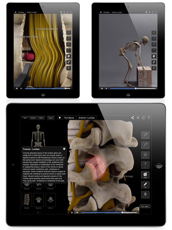 Spine Pro III