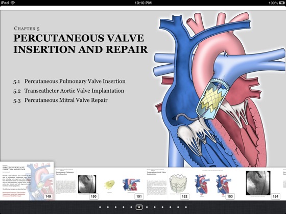 illustrated field guide to congenital heart disease and repair download