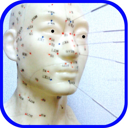 Chinese Acupuncture