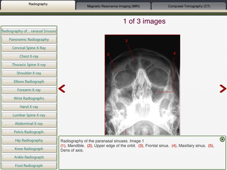MRI-Xray Human Body