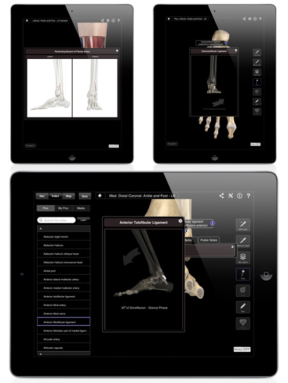 Ankle & Foot Pro III for iPad screenshot-4