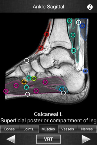 Monster Anatomy HD - Lower Limb screenshot 4