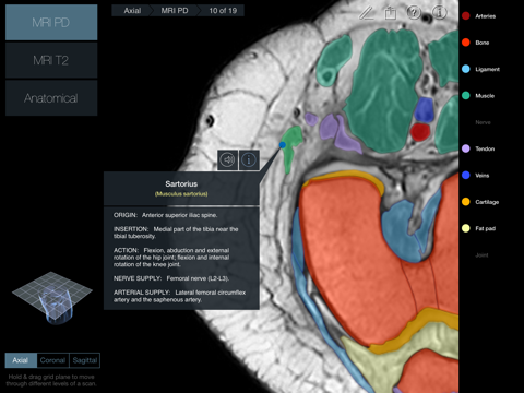 Radiology - Knee screenshot 3