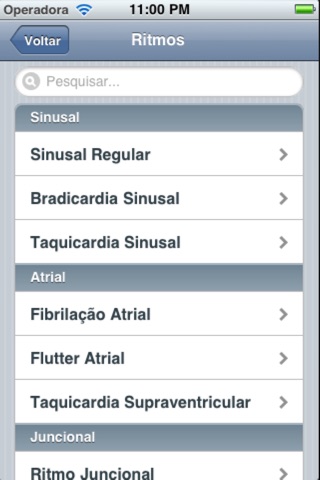 ECG screenshot 2