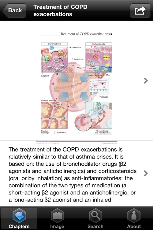 Miniatlas COPD screenshot-4