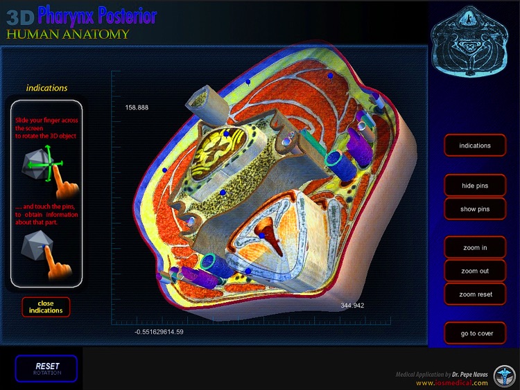 3D Pharynx Posterior