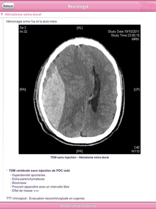 SMARTfiches Neurologie HD Free(圖2)-速報App