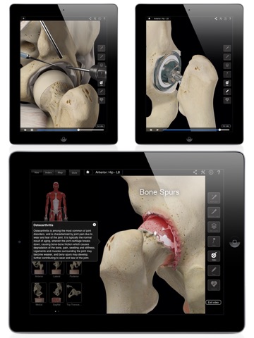 Hip Pro III for iPad screenshot 2