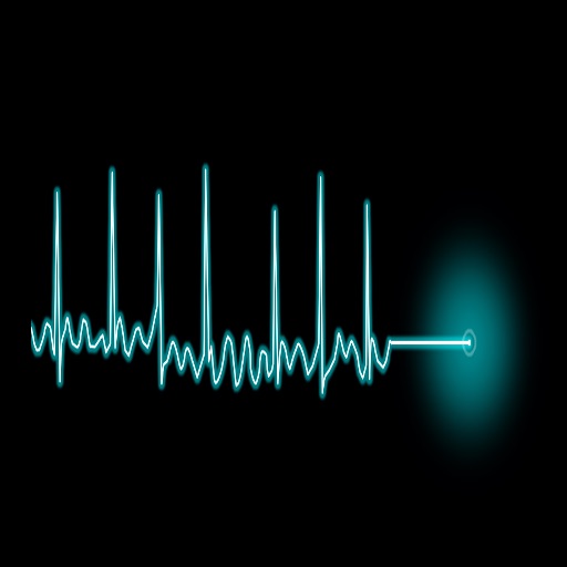 AnticoagulacionFA