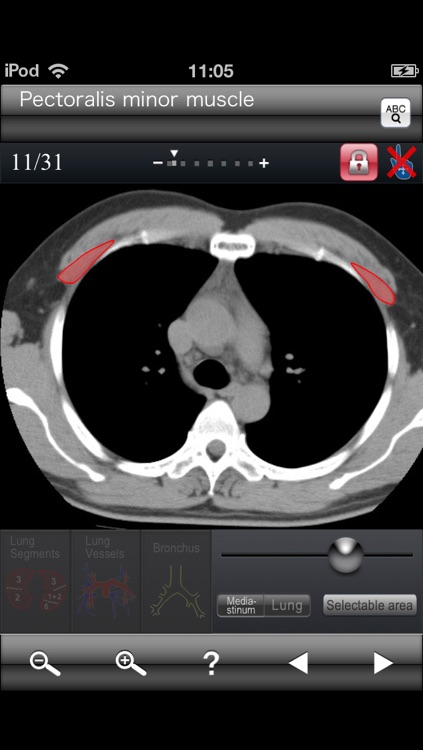 Chest CT Sectional Walker screenshot-4