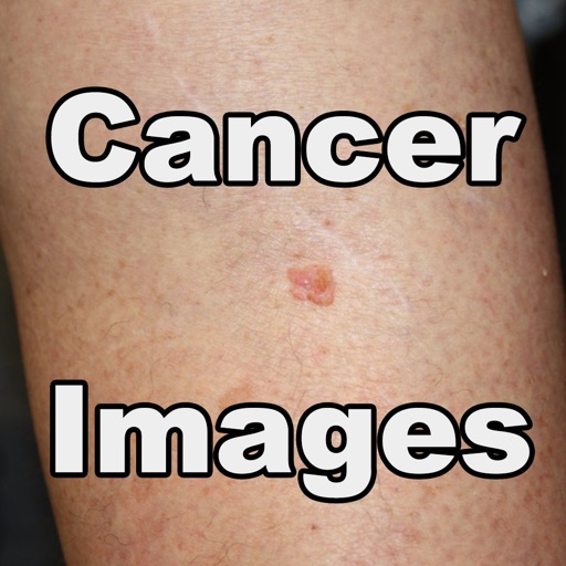 Cancer Images icon