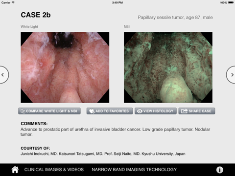 Urology NBI Atlas by Olympus screenshot 2