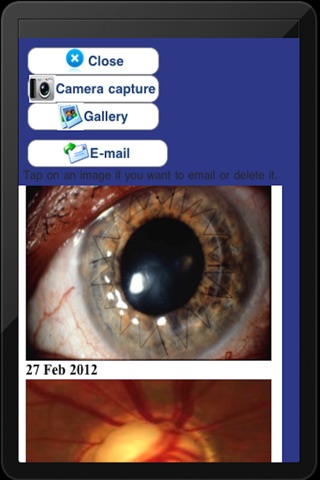 eyePatientsMobileFree screenshot 2