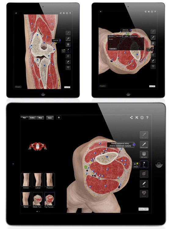 Elbow Pro III for iPad