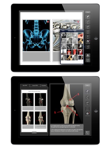 Orthopedic Patient Education screenshot 3