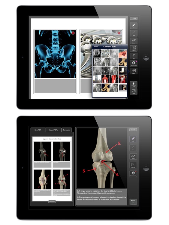 Orthopedic Patient Education