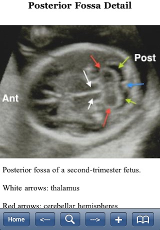 Handbook of High-Risk Obstetrics screenshot 2