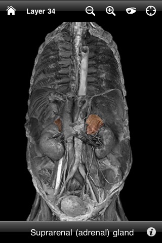 AnatomyLab screenshot 2