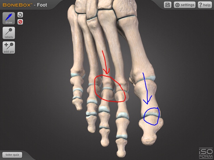 BoneBox Foot screenshot-3