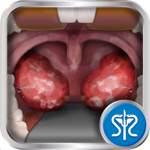 Surgery Squad's Virtual Tonsillectomy iOS App