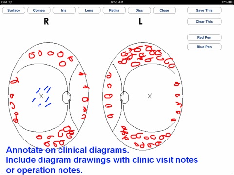 eyePatientsFree screenshot 3