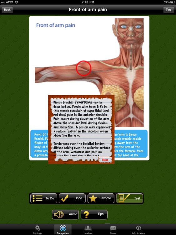 Muscle Trigger Points Doctor for iPad screenshot-4