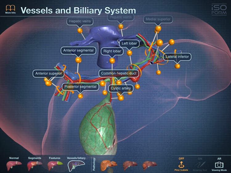 AR Liver Viewer screenshot-3