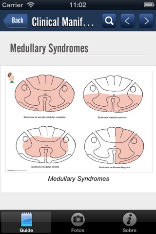 Spinal Cord Trauma screenshot 2