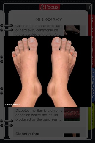 Animated Quick Reference Guide -  DiabeticFoot screenshot 3