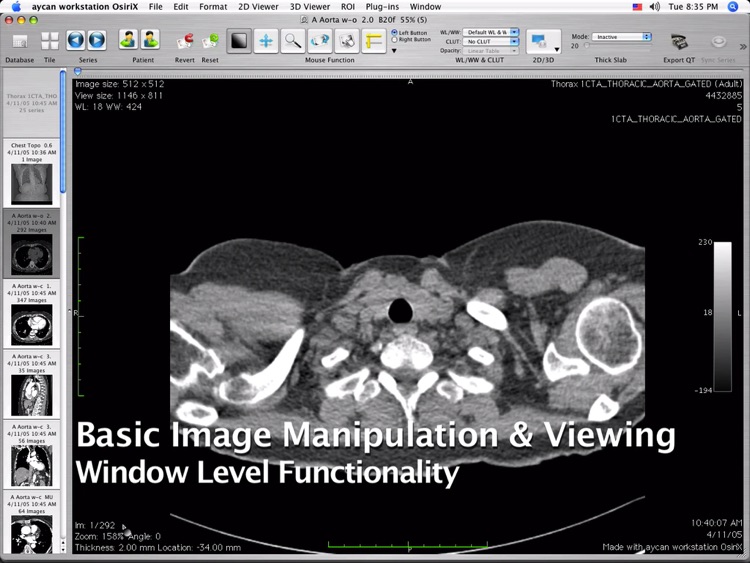 OsiriX PRO Video Tutorials