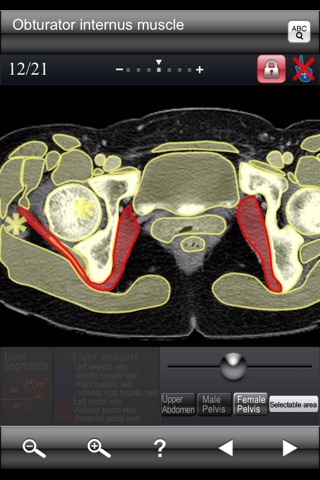 Abdominal CT Sectional Walker Lite screenshot 4