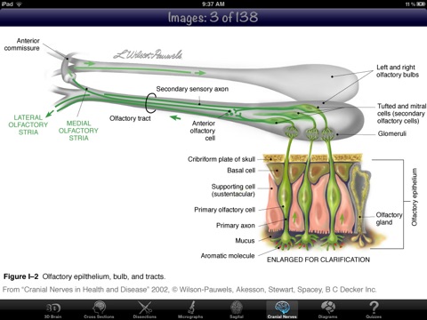 Anatomy Of The Brain 2D/3D screenshot 3