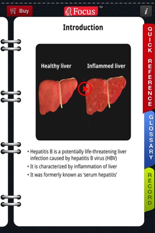 Animated Quick Reference Guide - HepatitisB screenshot 2