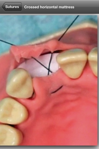 Suturing techniques Videos screenshot 3