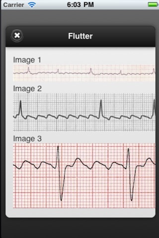 ECG screenshot 3